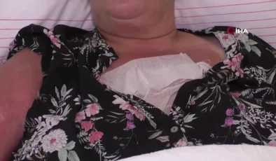 Düdüklü Tencere Bomba Gibi Patladı, Dehşeti Yaşayan Kadın: ‘Kapak Yüzüme Gelse Kurtuluşum Olmazdı’